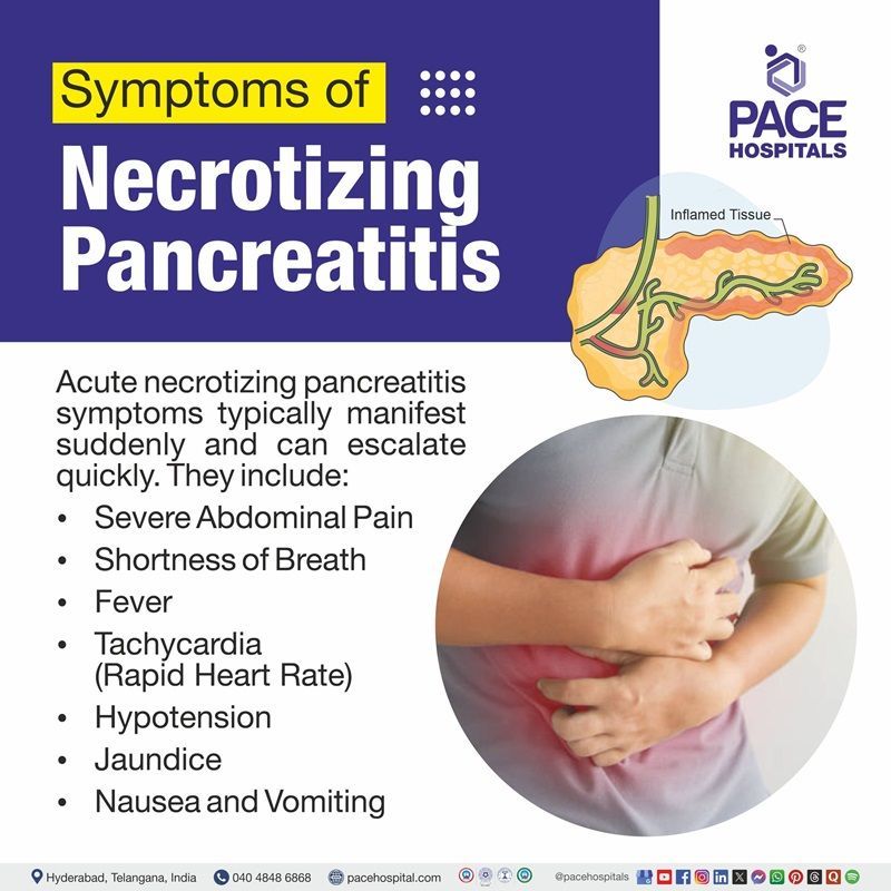 Acute necrotizing pancreatitis symptoms​ | Visual depicting necrotizing pancreatitis symptoms​