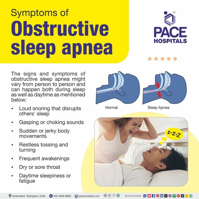 obstructive sleep apnea symptoms​ | obstructive sleep apnea symptoms adults​ | signs and symptoms of obstructive sleep apnea​ | central vs obstructive sleep apnea symptoms​ | obstructive sleep apnea OSA symptoms​