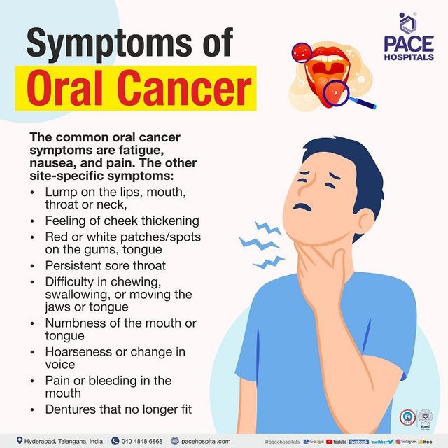 Oral Cancer in Young Adults: An Increasing Concern