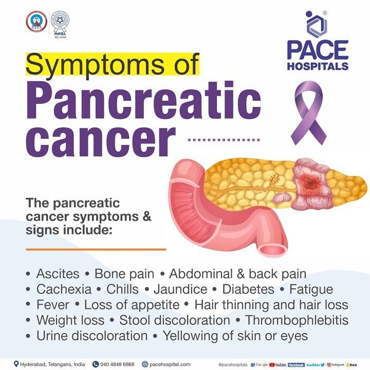 pancreatic cancer symptoms | signs of pancreatic cancer