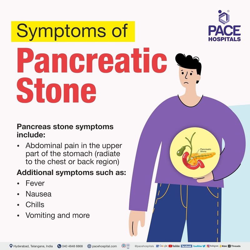 stone in pancreatic duct symptoms | pancreatic stones symptoms | pancreatolithiasis symptoms | pancreas stones symptoms