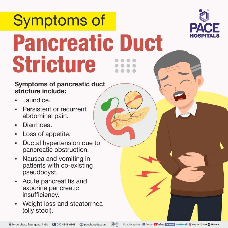 Symptoms of Pancreatic Duct Strictures | Benign and Malignant Pancreatic Ductal Strictures Symptoms