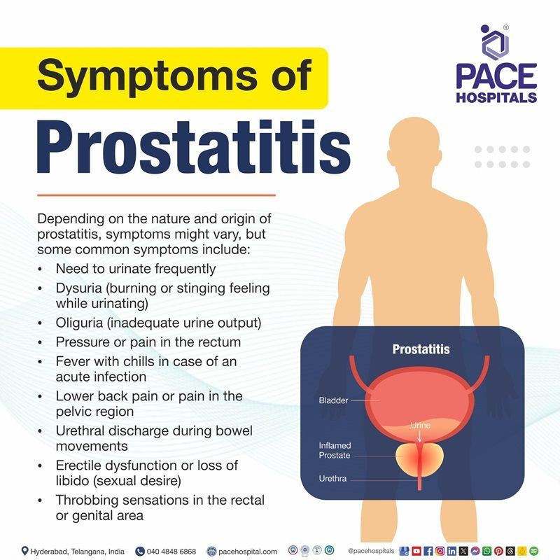 prostatitis symptoms | Symptoms of prostatitis | What are the symptoms of Prostatitis | Visual showing the different types of Prostatitis 