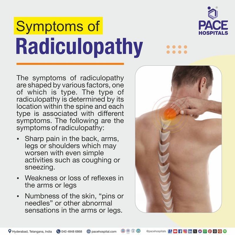 Radiculopathy Symptoms Symptoms of radiculopathy | cervical radiculopathy symptoms