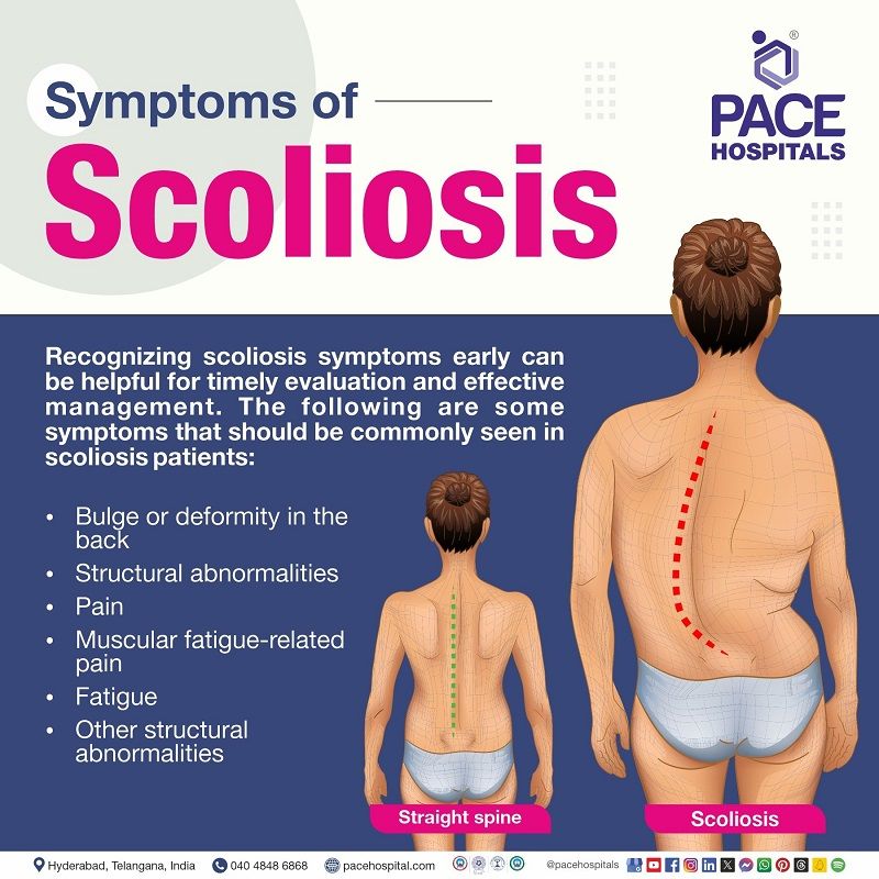 what are the symptoms of scoliosis | scoliosis symptoms | scoliosis disease symptoms | Visual indicating the symptoms of scoliosis | symptoms of scoliosis 
