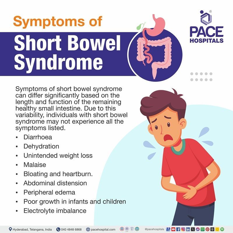 short bowel syndrome symptoms | symptoms of short bowel syndrome | various symptoms of short bowel syndrome | Visual depicting the various symptoms of short bowel syndrome