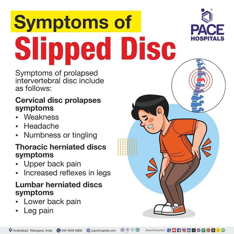 herniated disc symptoms | l5 s1 disc herniation symptoms | slipped disc symptoms | slipped disc symptoms lower back | slipped disc in back symptoms | visual illustrating the symptoms of Slipped disc and the person experiencing it
