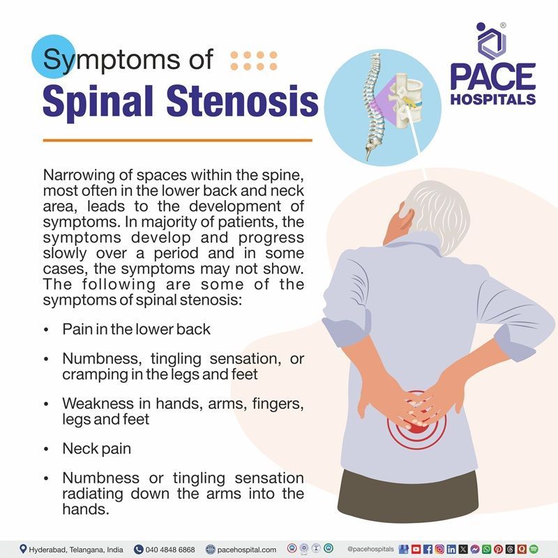 Spinal Stenosis Symptoms what are the symptoms of spinal stenosis | Spinal Stenosis Symptoms