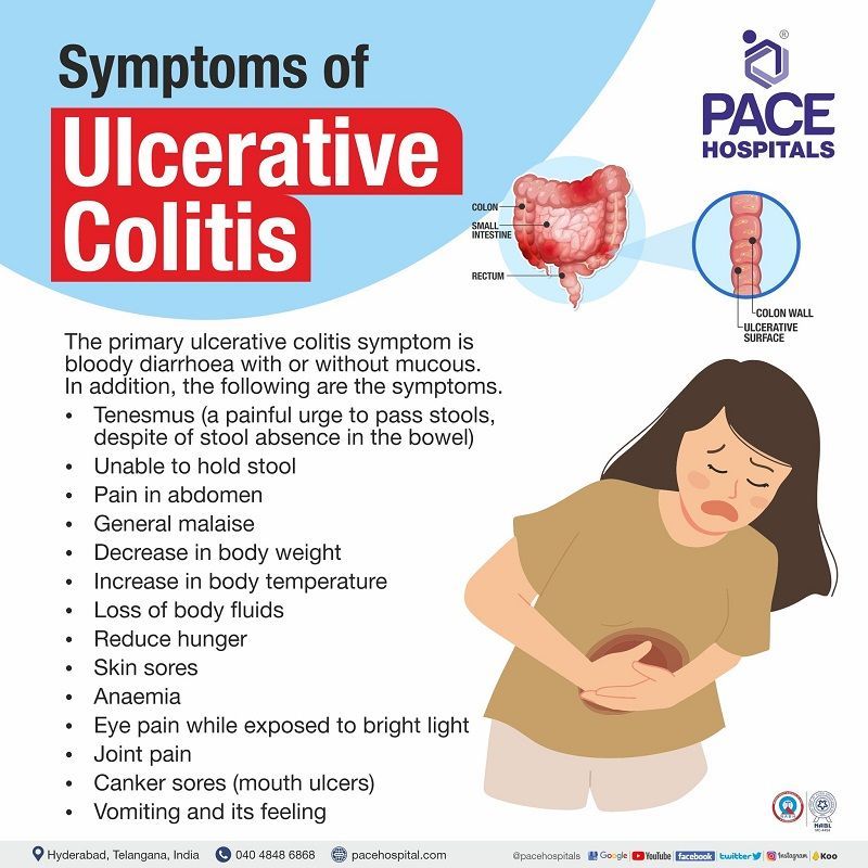 Ulcerative Colitis Symptoms Causes Types And Complications 3147