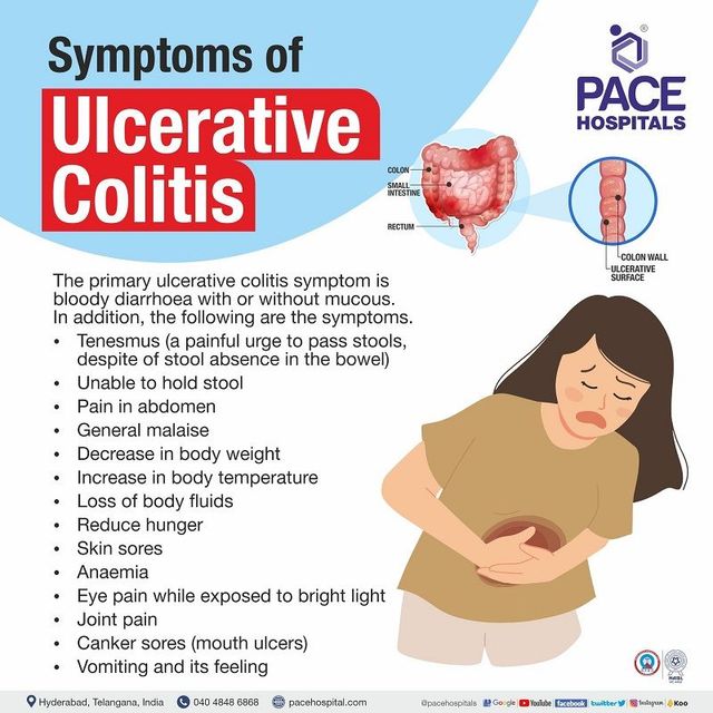 Diverticulitis vs. Ulcerative Colitis: Symptoms, Causes, Relief