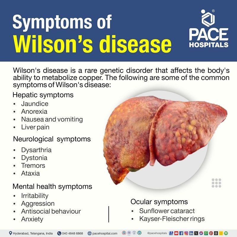 What are symptoms of Wilson's disease  | Wilson's disease symptoms |  Neurological symptoms | Visual depicting the symptoms of Wilson's disease and a liver affected by Wilson's disease 