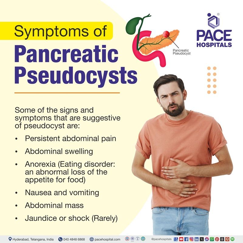 pancreatic pseudocyst symptoms​ | Visual depicting the symptoms of pancreatic pseudocyst