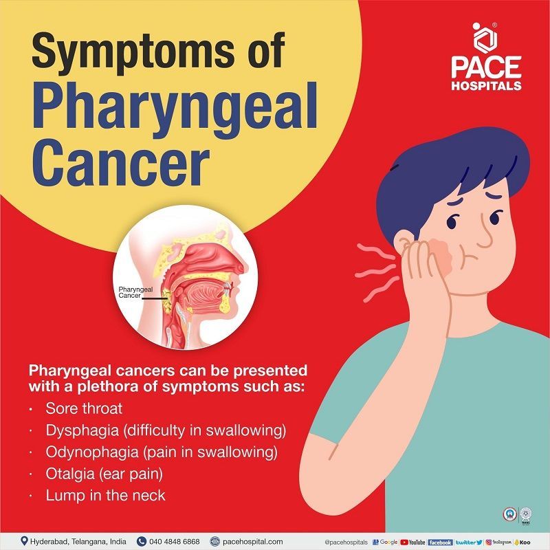 pharyngeal cancer symptoms | pharyngitis cancer symptoms | pharyngeal throat cancer symptoms | pharyngeal tonsil cancer symptoms