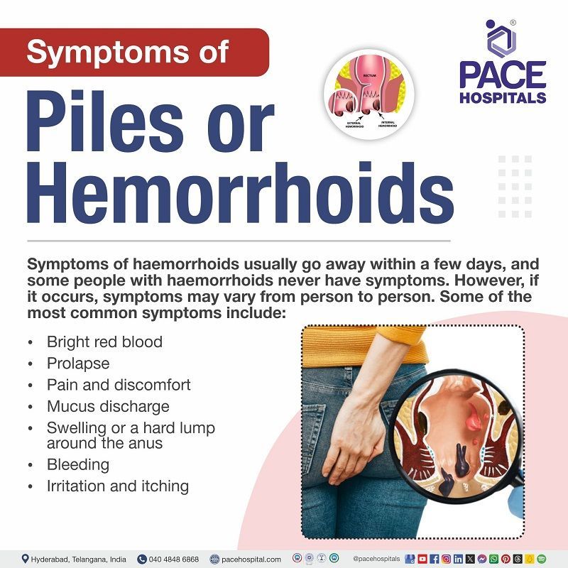 piles symptoms | internal piles | symptoms of piles in male and female | symptoms | piles starting symptoms |  Visual depicting the symptoms of Piles (Hemorrhoids)