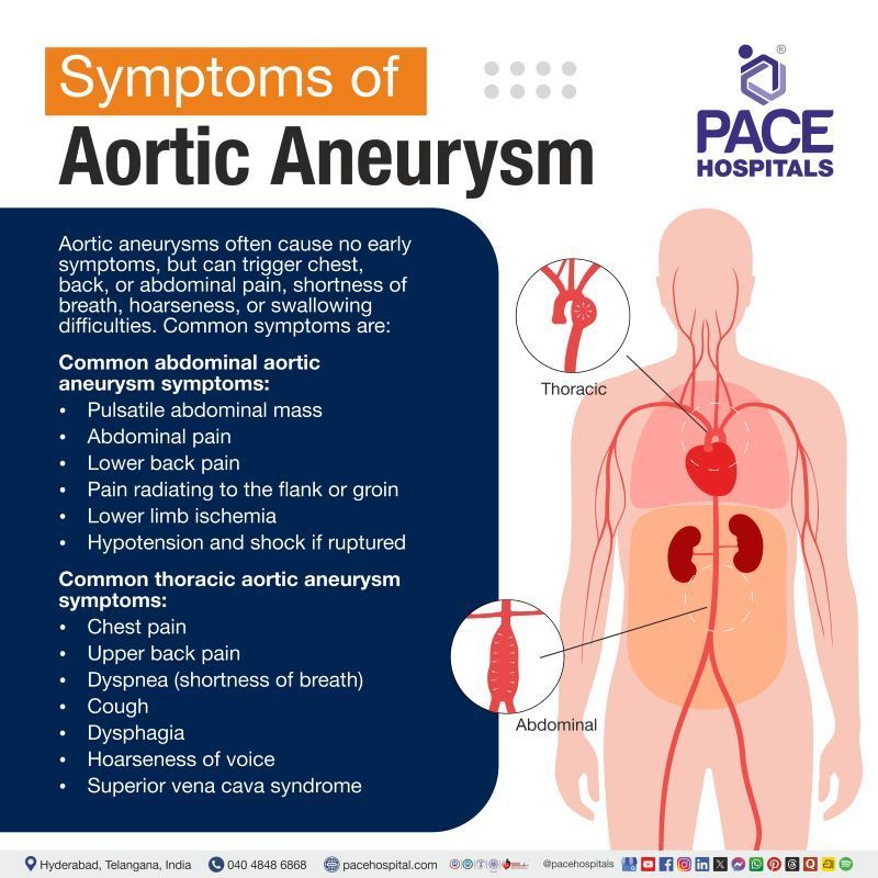 Aortic Aneurysm Symptoms | Early symptoms of aortic aneurysm | Signs and symptoms of aortic aneurysm