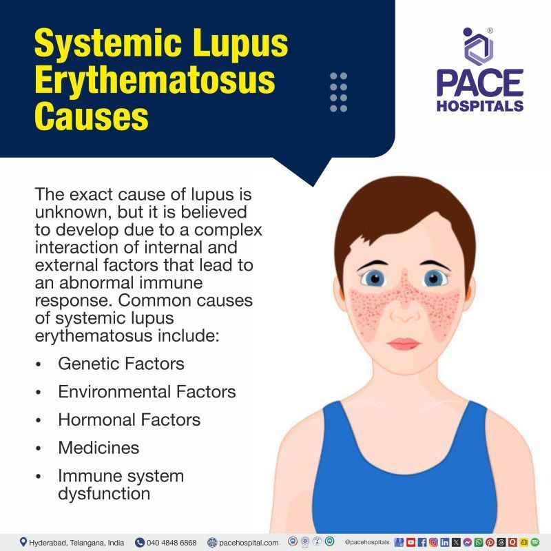 Systemic Lupus Erythematosus Causes | What causes lupus | What causes lupus disease