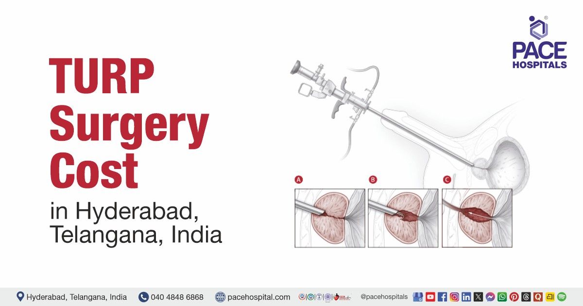 Cost of TURP Surgery in Hyderabad at PACE Hospitals, TURP Surgery cost estimate