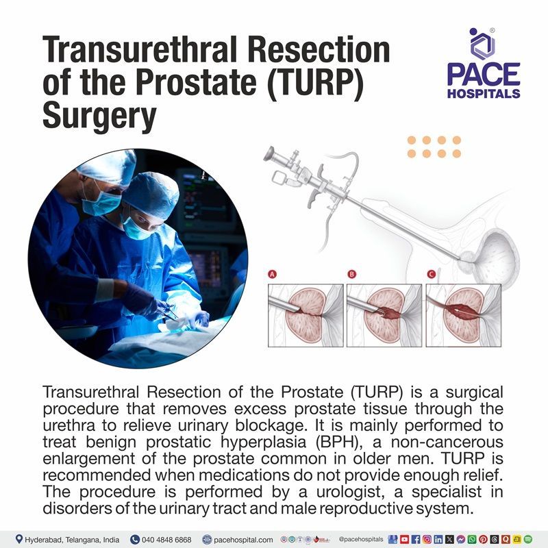 TURP Surgery | TURP Full Form | What is TURP