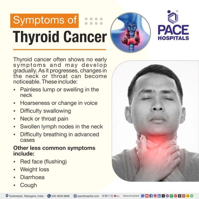 Thyroid Cancer: Types, Symptoms, Causes, Diagnosis & Treatment