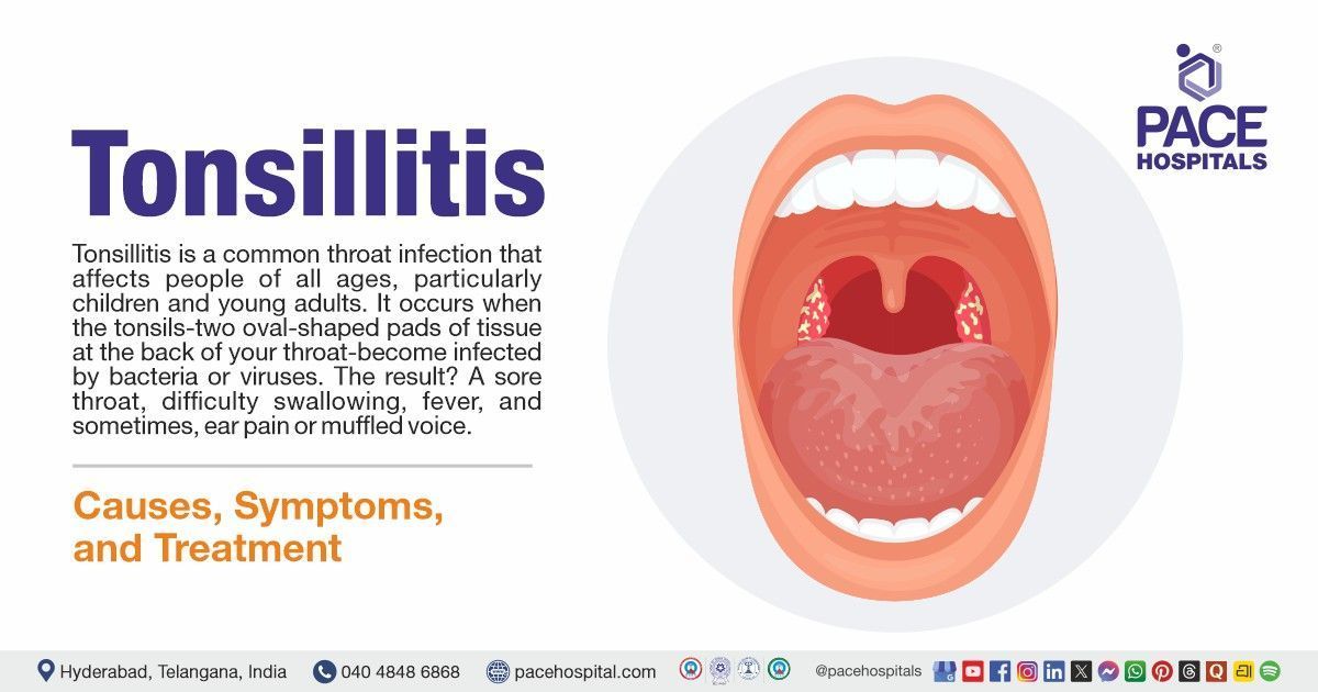 Tonsillitis, Causes, Symptoms, Treatment, Diet and Self Care Explained