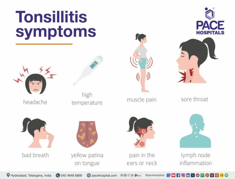 Tonsillitis symptoms | Pace Hospitals Tonsillitis symptoms | Pace Hospitals