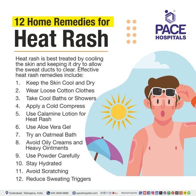 Home Remedies for Heat Rash and Prickly Heat in Summer