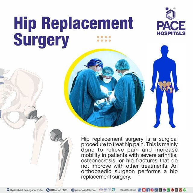 Types Of Total Hip Replacement Surgeries In India - Infoupdate.org