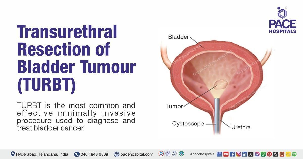turbt-bladder-tumour-resection-pace-hospitals-hyderabad
