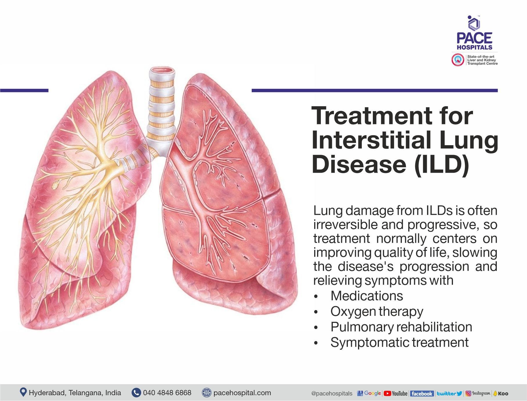 Symptoms of Interstitial Lung Disease (ILD) | Pace Hospitals
