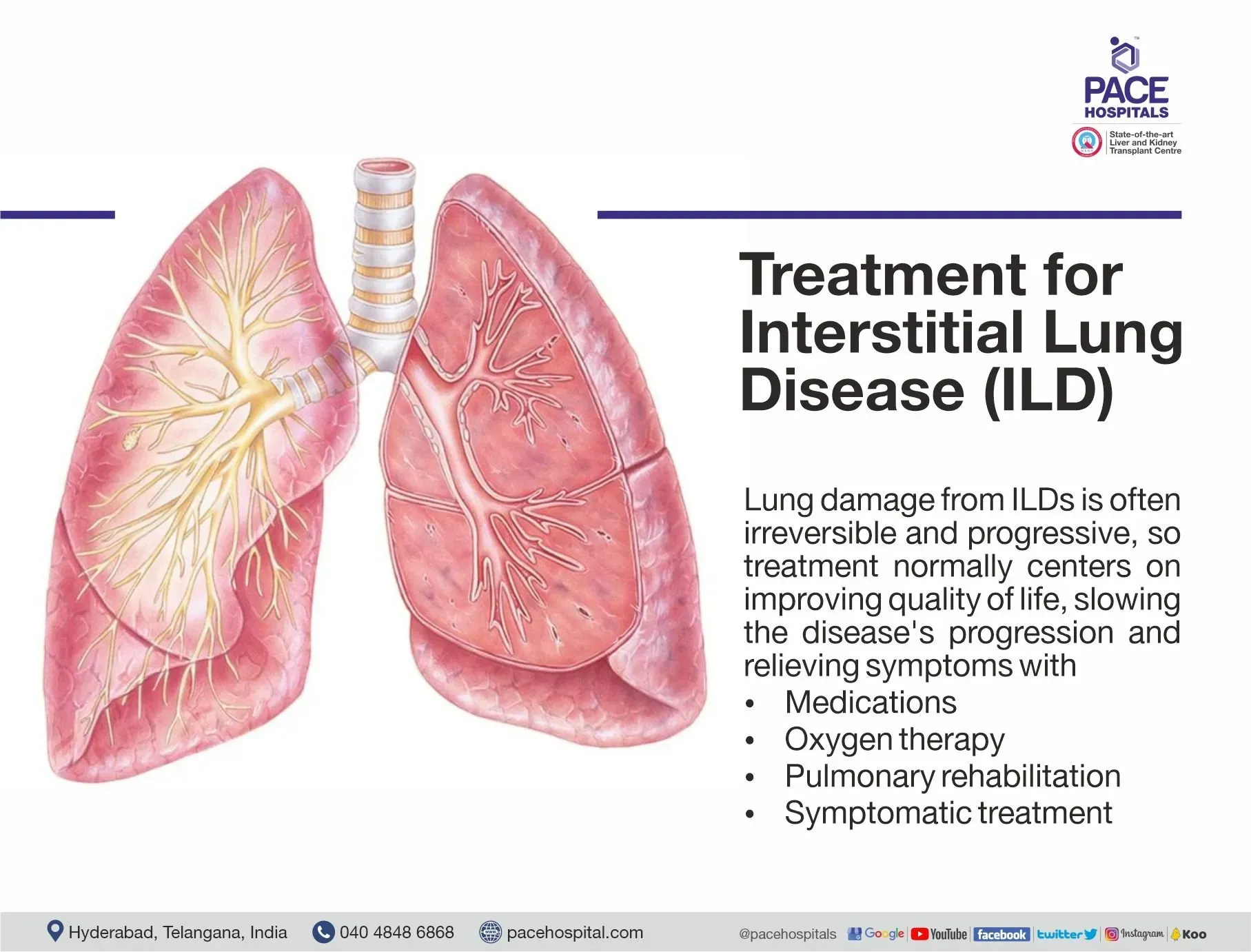 interstitial lung disease treatment | interstitial lung disease alternative treatment | ILD disease treatment in India | ILD disease treatment | treatment of ILD | Visual depicting the treatment of  Interstitial lung disease
