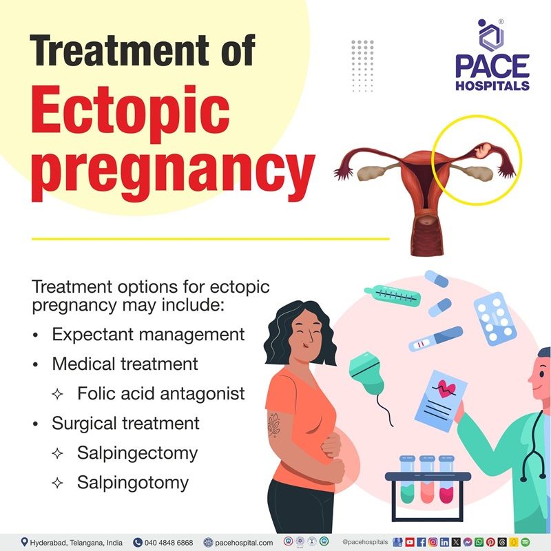 Best Ectopic Pregnancy Treatment Hospital in Hyderabad | Ectopic Pregnancy Surgeries Doctors In Hyderabad | Best Ectopic Pregnancy Treatment Doctors in Hyderabad | Best Treatment for Ectopic pregnancy in Women