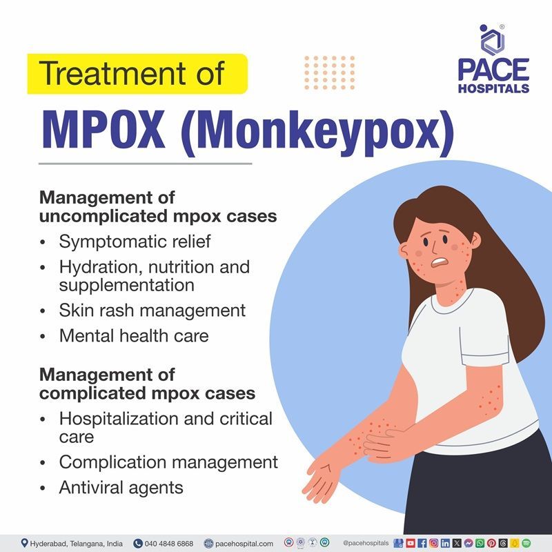 Monkeypox (Mpox) treatment | treatment of Monkeypox (Mpox) | Monkeypox virus treatment | Visual depicting the Treatment of Monkeypox (Mpox)