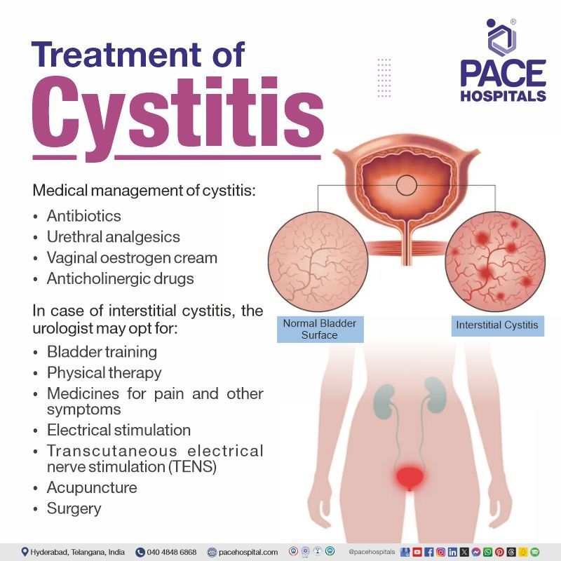 cystitis treatment | interstitial cystitis treatment | chronic cystitis treatment |  what is the best treatment for cystitis | Visual  suggesting Cystitis treatment
