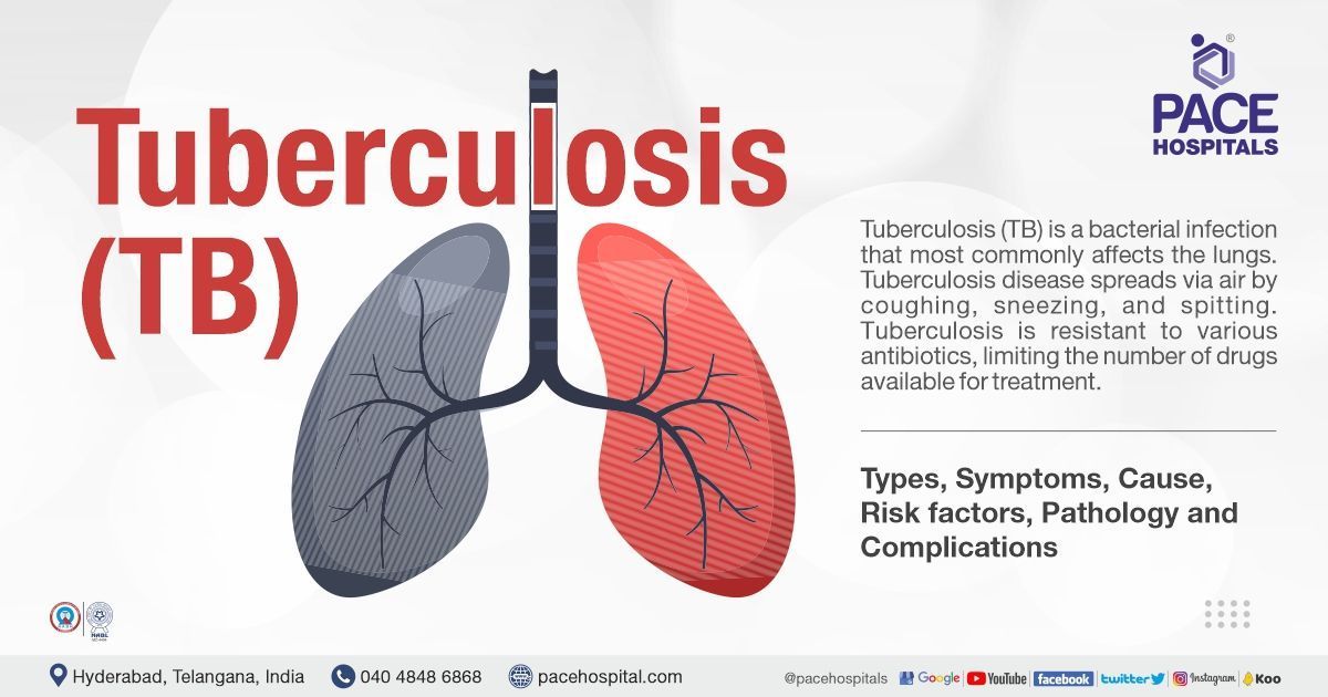 Tuberculosis Symptoms Types Causes Risk Factors 42 OFF