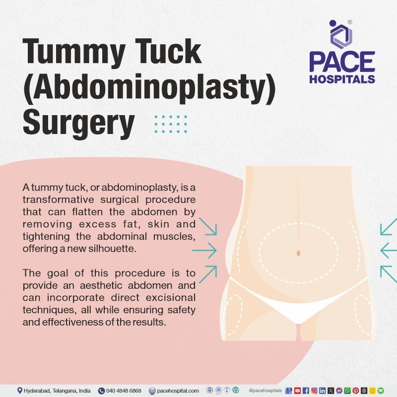 best hospital for Tummy tuck in Hyderabad | Tummy tuck surgery meaning | Abdominoplasty Surgery cost in Hyderabad | best tummy tuck procedure in Hyderabad | abdominoplasty near me