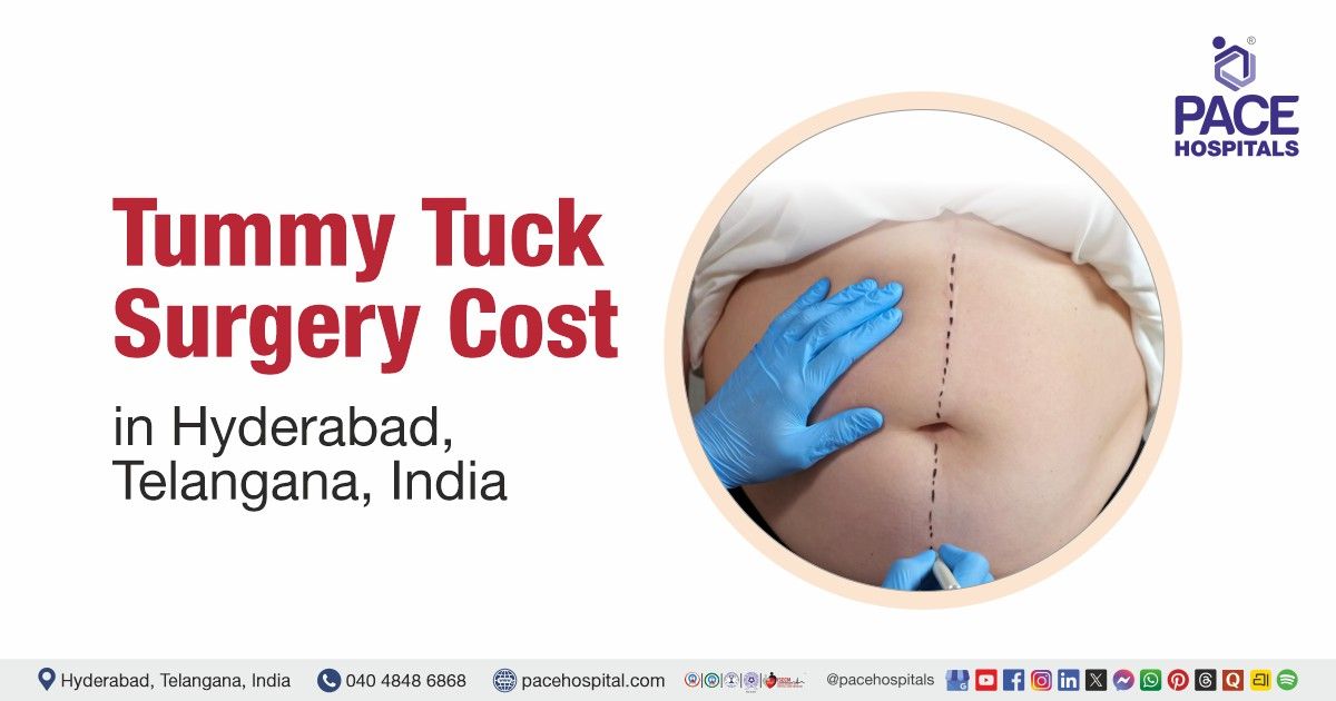 Cost of Tummy Tuck Surgery in Hyderabad at PACE Hospitals, Tummy Tuck Surgery cost estimate