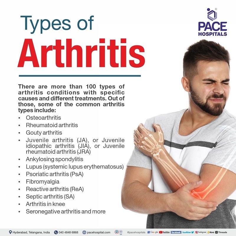 different types of arthritis disease | how many types of arthritis disease | most common type of arthritis disease | arthritis types symptoms and treatment | various types of arthritis disease