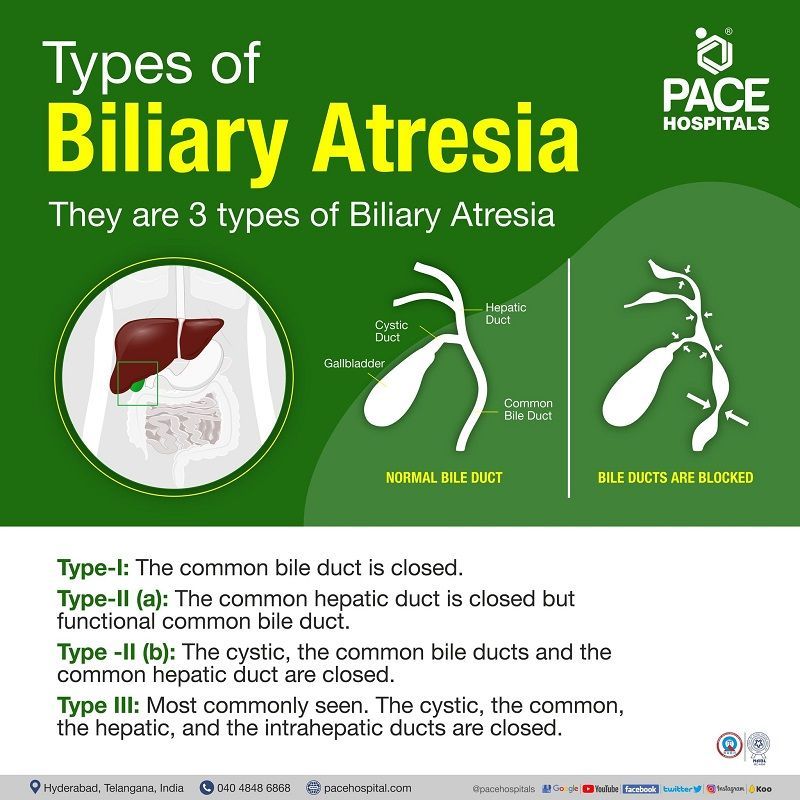 biliary atresia types