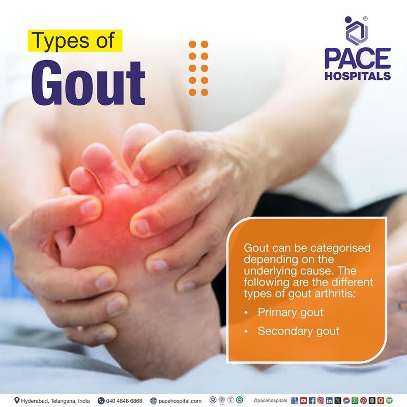Types of Gout | Different Types of Gout | Gout Types