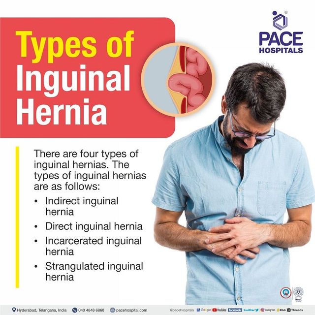 Inguinal Hernia - Signs and Symptoms, Types, Causes, Risk Factors