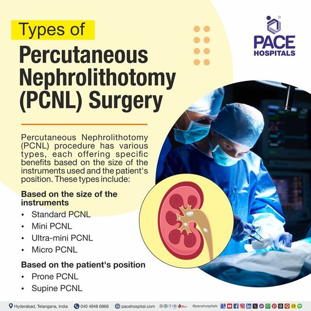 How Long Does Percutaneous Nephrolithotomy Take