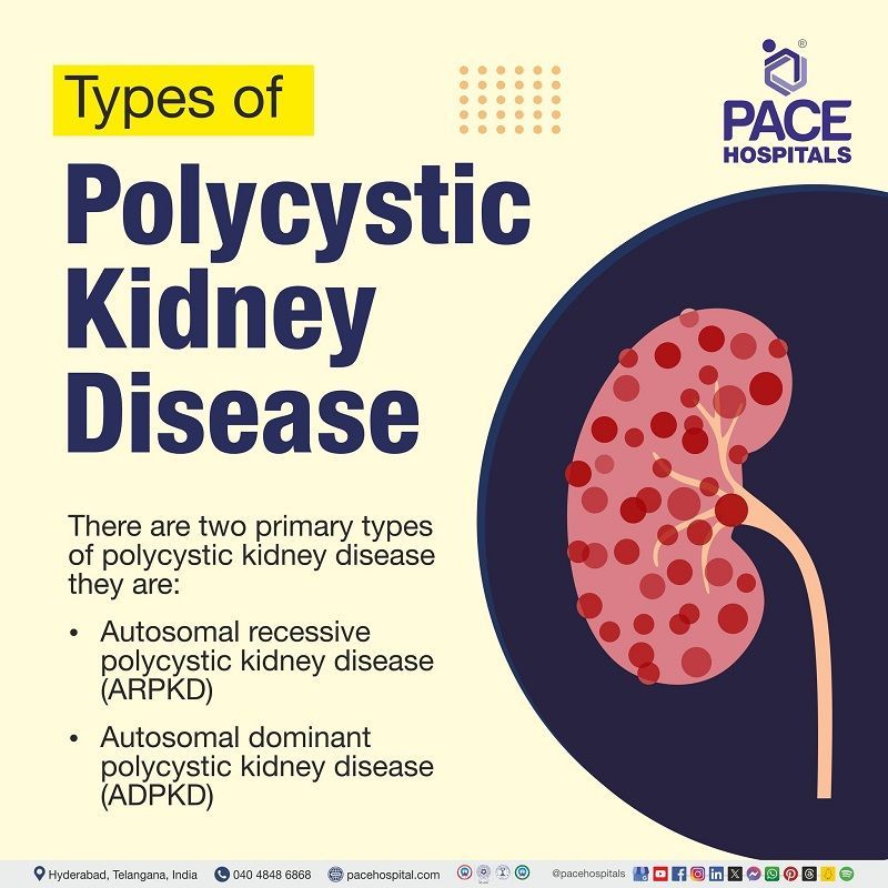 Types of polycystic kidney disease types of polycystic kidney disease | polycystic kidney disease types | visual depicting the types of polycystic kidney disease | various types of polycystic kidney disease