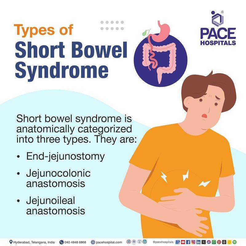 Types of short bowel syndrome types of short bowel syndrome | Short bowel syndrome types | what are the types of Short bowel syndrome | Visual showing the different types of Short bowel syndrome