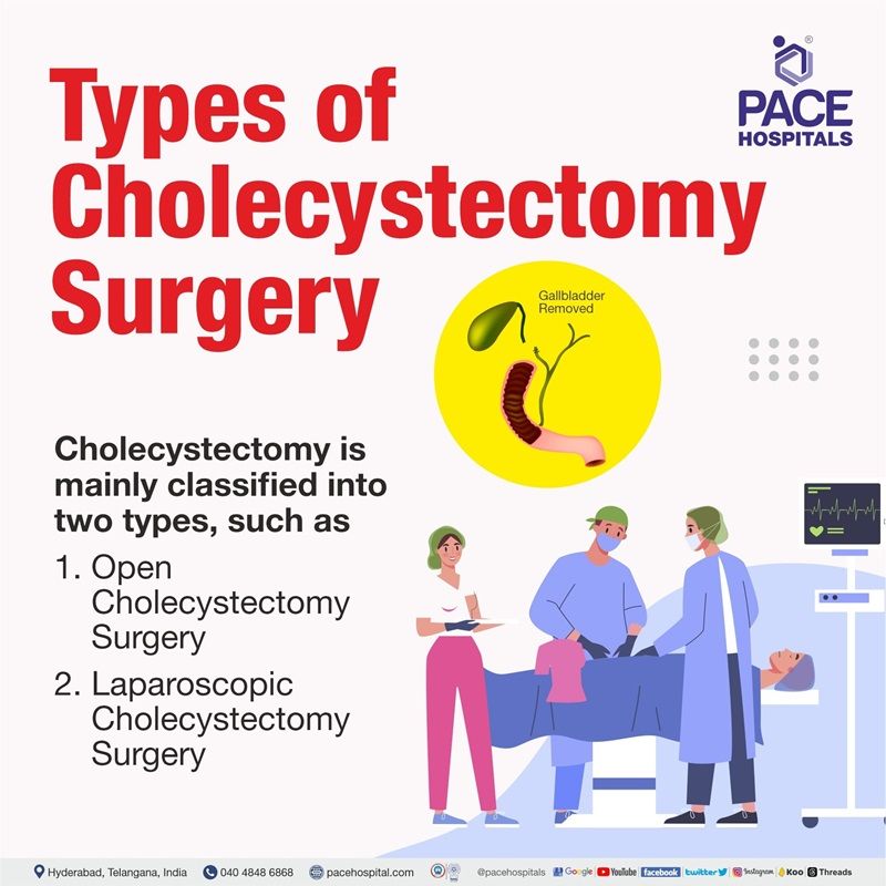 types of cholecystectomy surgery | type of cholecystectomy surgery | gallbladder removal surgery | cholecystectomy type | gallbladder removal side effects