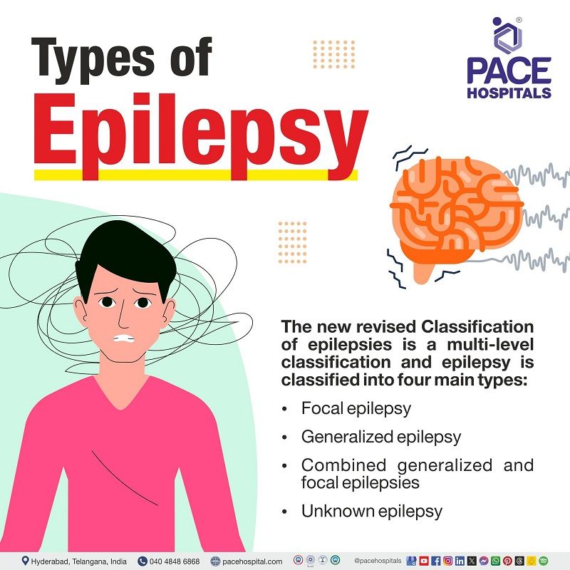 Types of epilepsy | Classifications of Epilepsy | Different types of epilepsy | Different epileptic conditions | Epileptic episodes and types | Visual elaborating revised classification of epilepsy and types. 