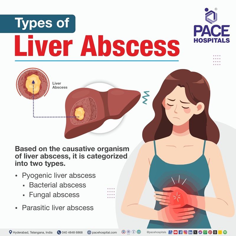 types of liver abscess | liver abscess | types | Visual out lining the various types of liver abscess | Pyogenic liver abscess | parasitic liver abscess