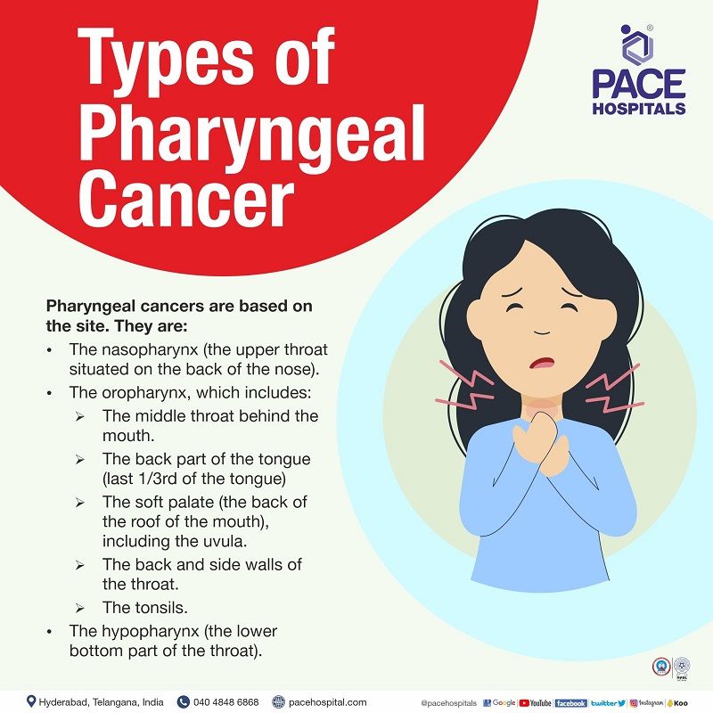types of pharyngeal cancer | pharyngitis cancer types | pharyngeal cancer types