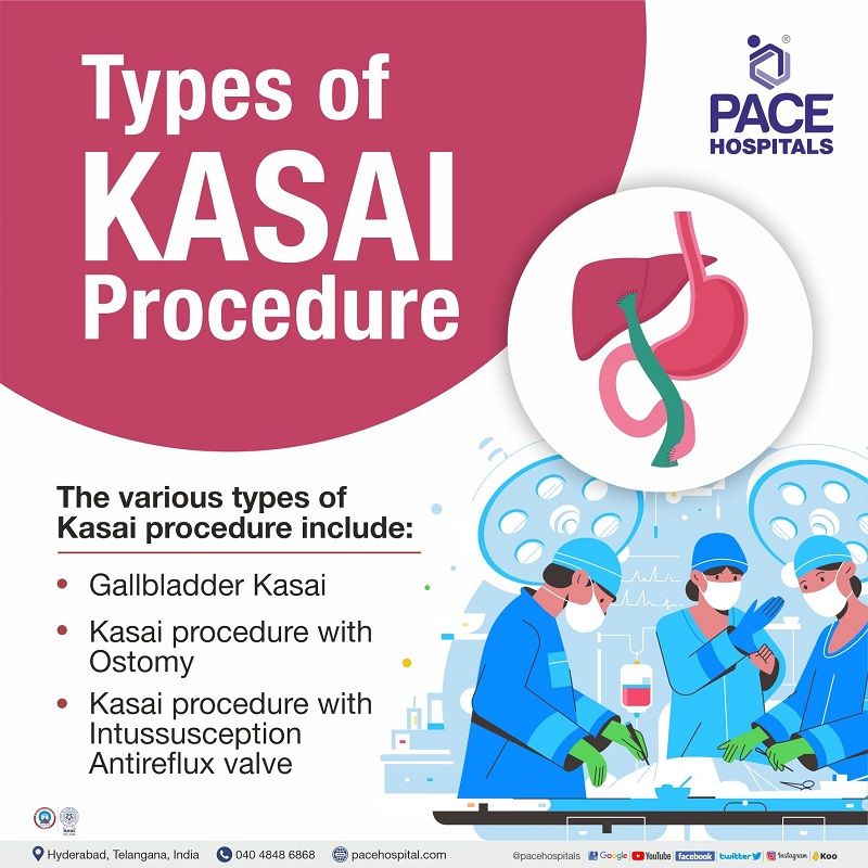 types of kasai procedure | best hospital for kasai procedure in Hyderabad India | centre for biliary atresia kasai procedure