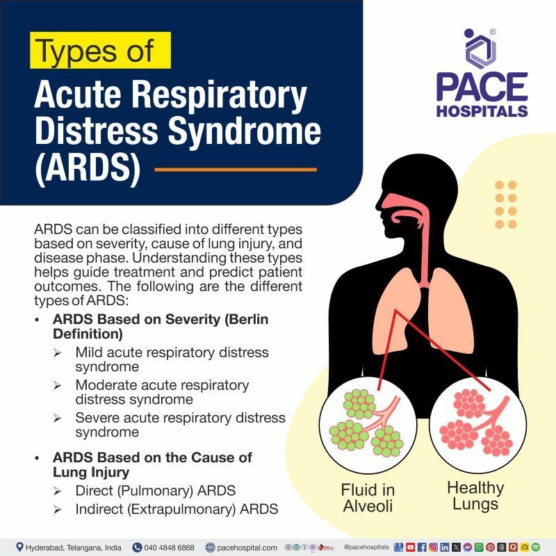 Types of ARDS | ARDS type | Acute Respiratory Distress Syndrome Types