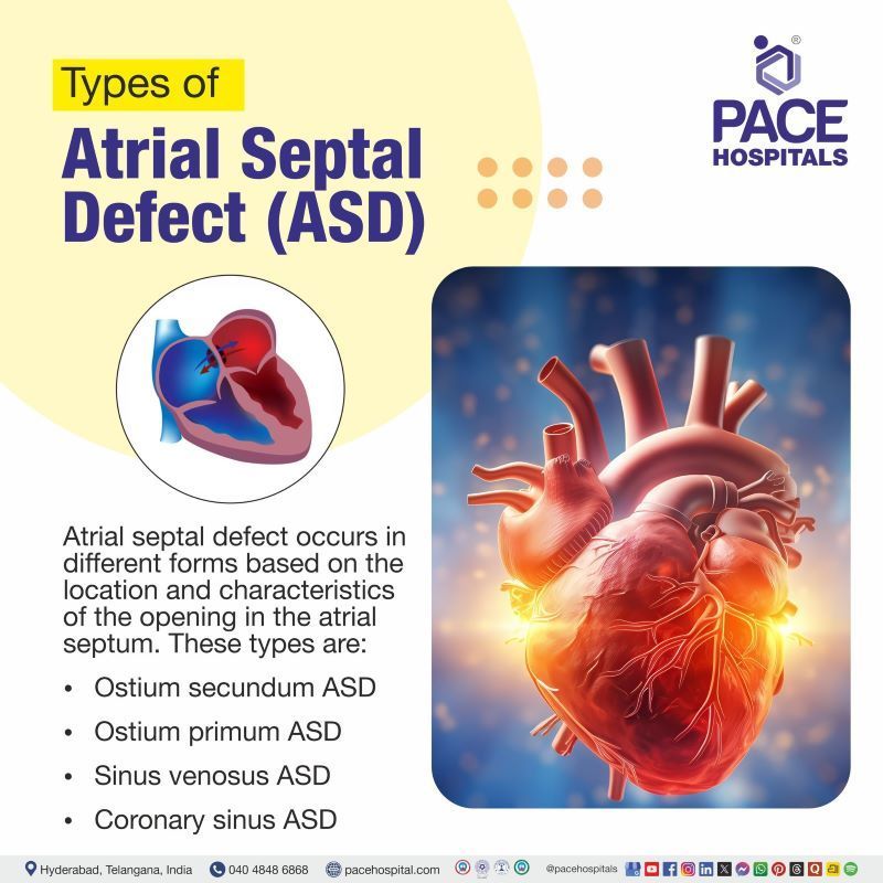 Types of ASD (Atrial Septal Defect) Types of ASD | Atrial septal defect types | Most common type of atrial septal defect